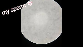 Sperm Observation 1 &lpar;No Abstinence&rpar;